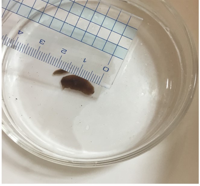 ビワオオウズムシの赤ちゃん